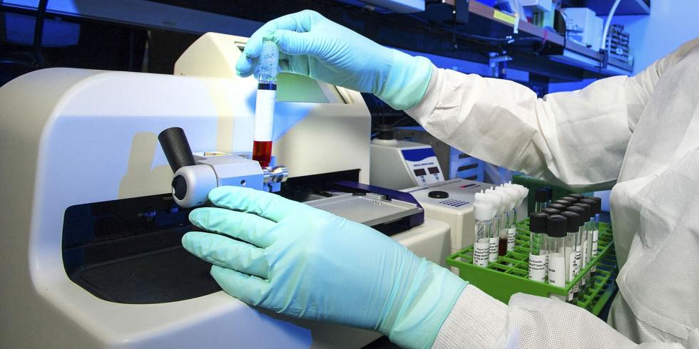 Clinical Trial