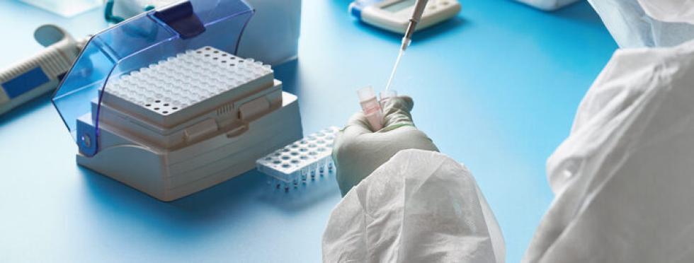 Lab Test